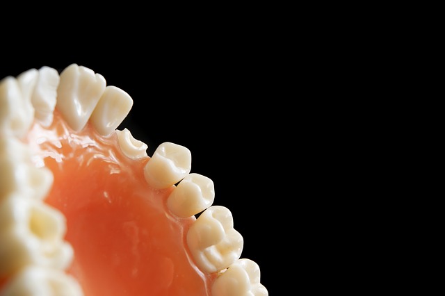 Vam manjka zob? Pravo rešitev morda ponujajo implantati!